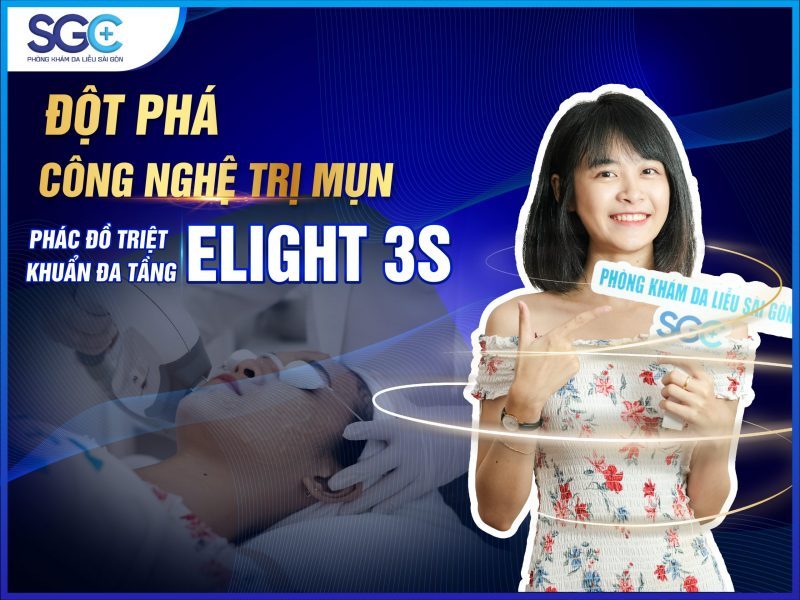 ĐỘT PHÁ CÔNG NGHỆ TRỊ MỤN BẰNG PHÁC ĐỒ TRIỆT KHUẨN ĐA TẦNG CÔNG NGHỆ CAO ELIGHT 3S