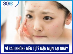 VÌ SAO KHÔNG NÊN TỰ Ý NẶN MỤN TẠI NHÀ