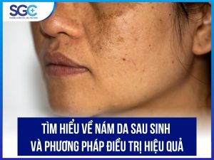 TÌM HIỂU VỀ NÁM DA SAU SINH VÀ PHƯƠNG PHÁP ĐIỀU TRỊ HIỆU QUẢ