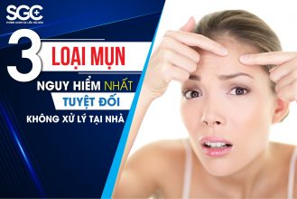 3 LOẠI MỤN TUYỆT ĐỐI KHÔNG ĐƯỢC CHỦ QUAN