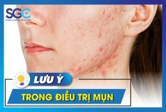LƯU Ý CHĂM SÓC DA MỤN NHẤT ĐỊNH PHẢI BIẾT