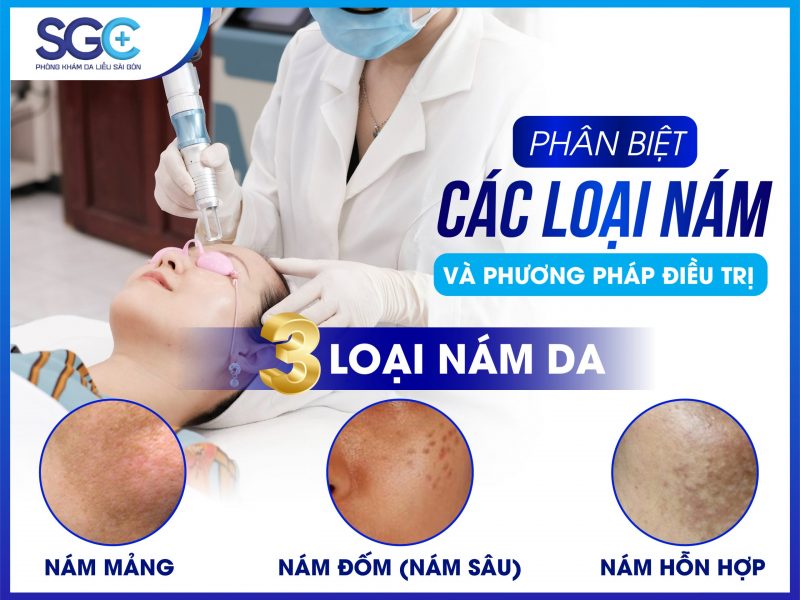 PHÂN BIỆT CÁC LOẠI NÁM VÀ PHƯƠNG PHÁP ĐIỀU TRỊ