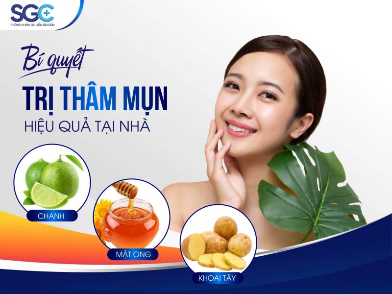 BÍ QUYẾT TRỊ THÂM MỤN HIỆU QUẢ TẠI NHÀ