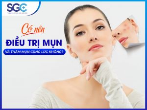 CÓ NÊN ĐIỀU TRỊ MỤN VÀ THÂM MỤN CÙNG LÚC KHÔNG?