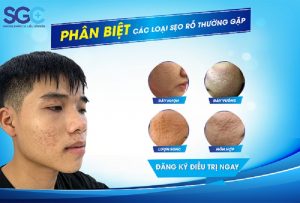 NHẬN DẠNG CÁC LOẠI SẸO RỖ THƯỜNG GẶP
